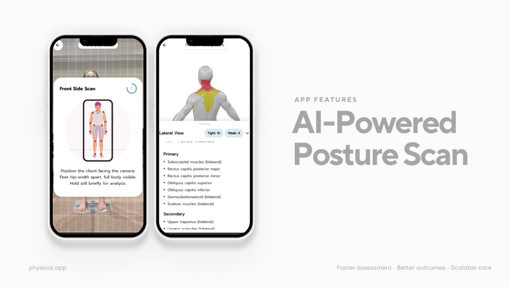 AI Scan -PhysioAI