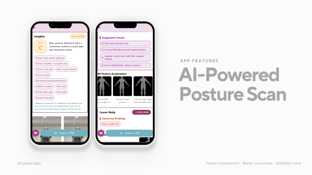 Personalized Exercise Plan for Shoulder Pain-PhysioAI