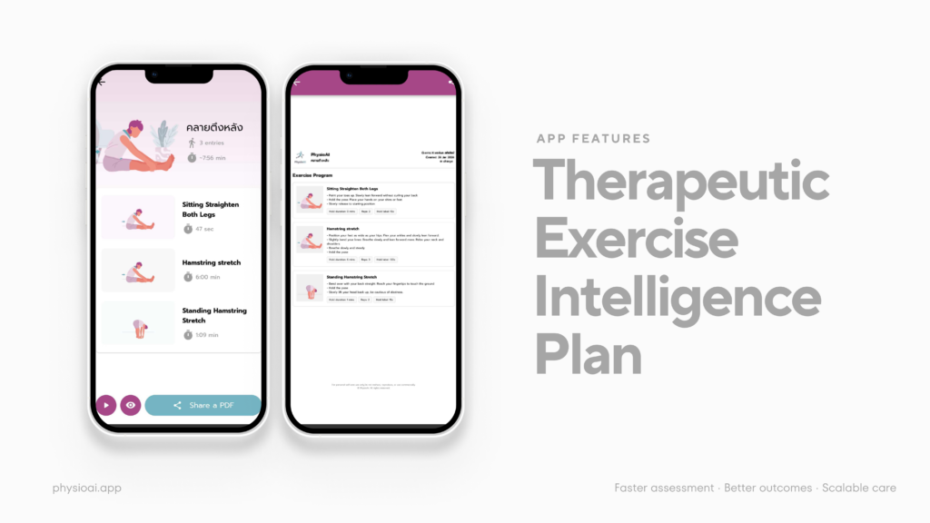Personalized Exercise Plan for Lower back Pain-PhysioAI