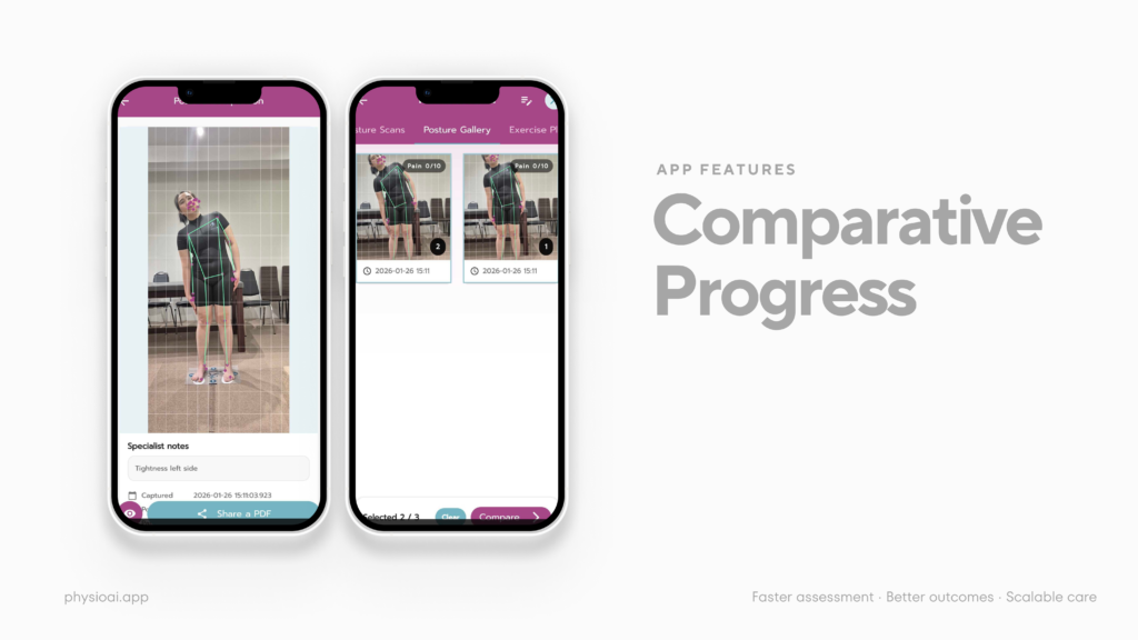 Comparative Progress-PhysioAI